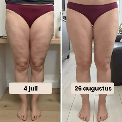 Celluxe™ Lift, Vormt en Stimuleert Tegelijk