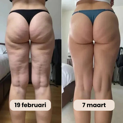 Celluxe™ Lift, Vormt en Stimuleert Tegelijk
