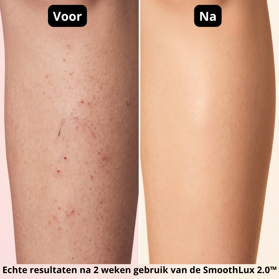 Smoothlux 2.0™ Intimate Trimmer