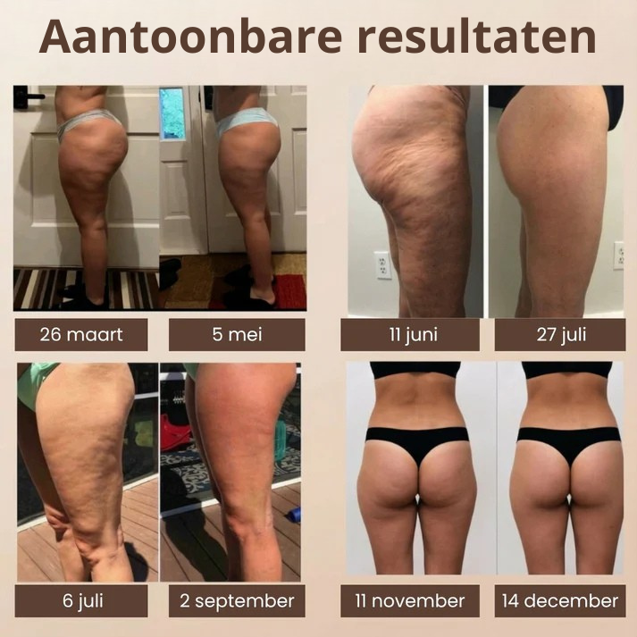 Celluxe™ Lift, Vormt en Stimuleert Tegelijk