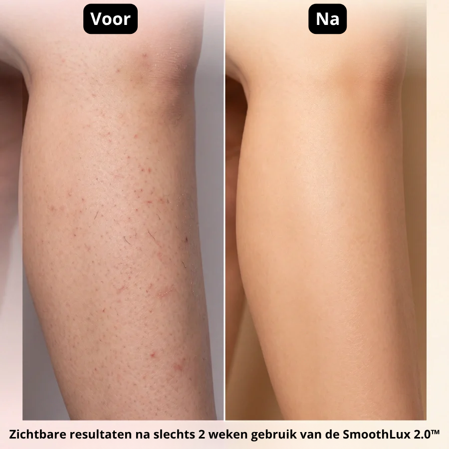 Smoothlux 2.0™ Intimate Trimmer