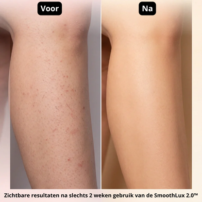 Smoothlux 2.0™ Intimate Trimmer